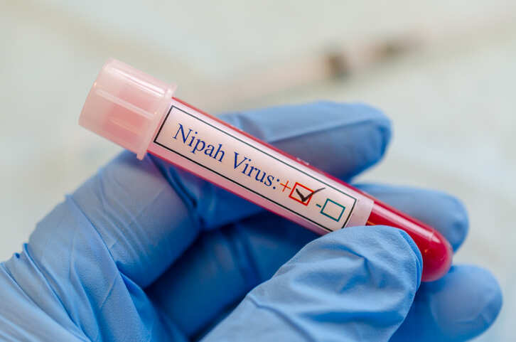 “Nipah” virusuna qarşı peyvənd insanlar üzərində sınaqdan keçiriləcək