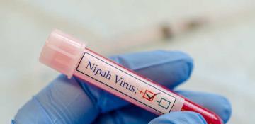 “Nipah” virusuna qarşı peyvənd insanlar üzərində sınaqdan keçiriləcək