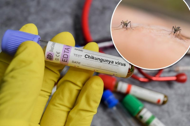 Bolivia confirms three deaths from Chikungunya fever