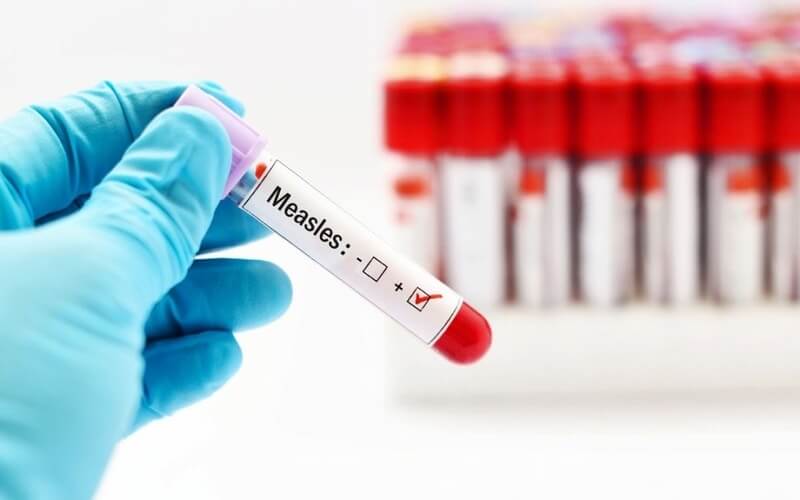 New Zealand records two new measles cases