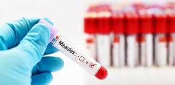 New Zealand records two new measles cases