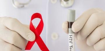 Azerbaijan records 1,287 new HIV cases in 2025