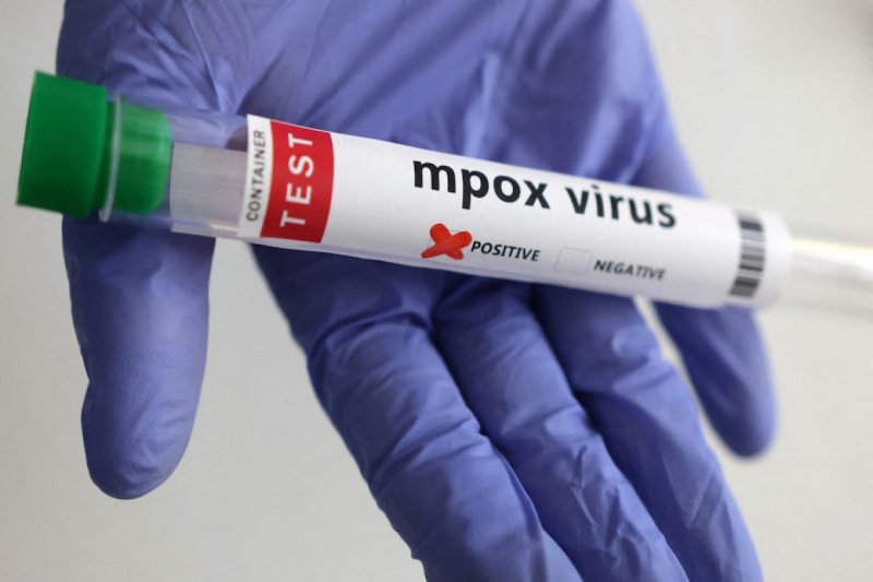 Singapore confirms first community mpox cases