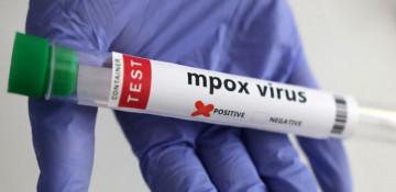 Singapore confirms first community mpox cases