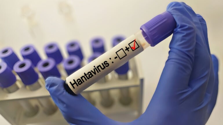 İspaniyada hantavirusa ilk yoluxma faktı rəsmən qeydə alınıb