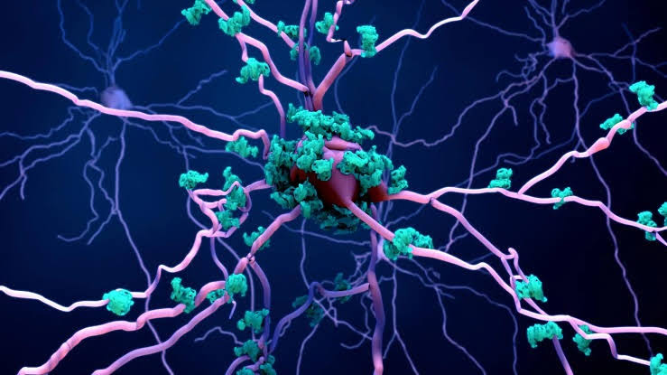 Scientists discover how Alzheimer's may destroy brain cells