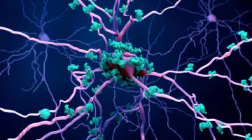 Scientists discover how Alzheimer's may destroy brain cells