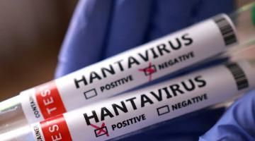 Chile issues first nationwide hantavirus health alert
