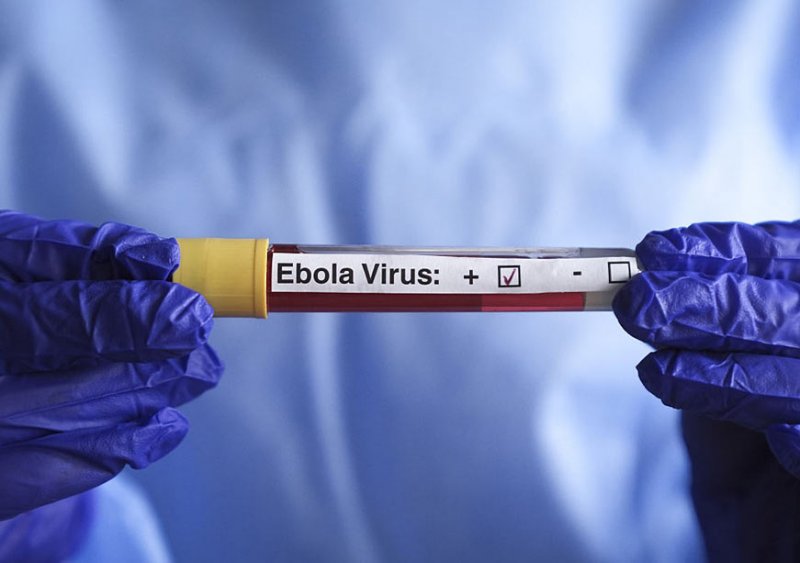 ÜST: Konqoda Ebola epidemiyası davam edir, ölənlərin sayı 3 510 nəfərə çatıb
