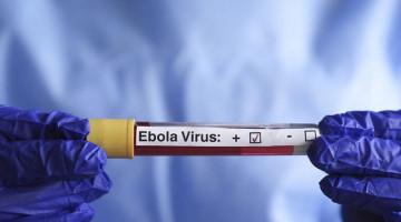 ÜST: Konqoda Ebola epidemiyası davam edir, ölənlərin sayı 3 510 nəfərə çatıb